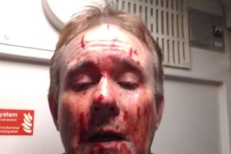 Revealed: Shocking injuries of train driver hit by a brick at 70mph